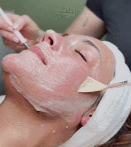 tratamiento facial mataro, higiene facial, limpieza facial, poros abiertos, arrugas, is clinical